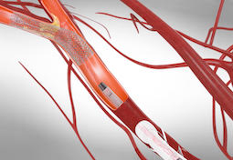 UP medical-device agency